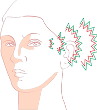 Last inn bildet i Galleri-visningsprogrammet, INTENS HODEPINE?